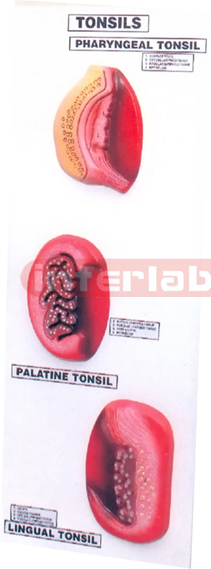 TONSILS